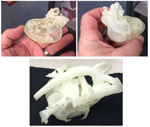 Photo of How Do 3D Printed Heart Models Impact Surgery?
