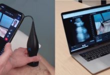 Photo of Ultrasound-based Telemedicine Platform for Remote Exam launched by Butterfly Network