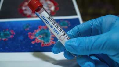 Photo of Biosup Launches door-to-door Diagnostic Services for Coronavirus Testing