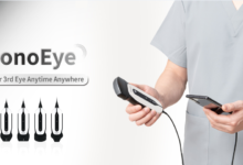 Photo of Handheld Ultrasound System, Sonoeye, launched