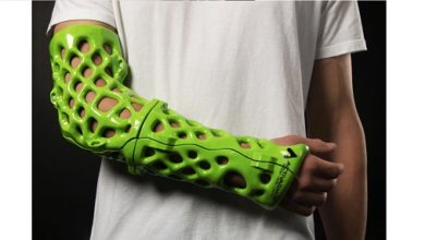 Photo of ActivArmor launches 3D-printed orthopaedic casts 