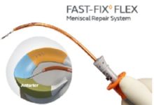 Photo of Smith+Nephew launches FAST-FIX FLEX Meniscal Repair System