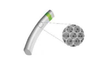 Photo of iSTAR Medical to start trial for MINIject in glaucoma patients