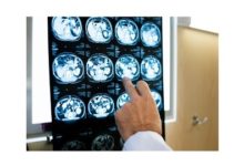 What holds back radiologists’ productivity