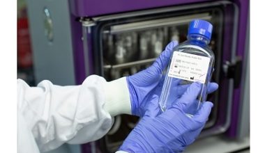 Photo of PCR Biosystems expands comprehensive range of diagnostic reagents