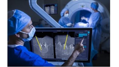 Photo of SPARSH Hospital, Sita Bhateja Trust introduce high precision surgical imaging and navigation system