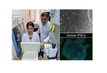 Photo of IITG-CMC team introduces specific genes into skin cells to form iPSCs