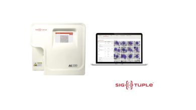 Photo of SigTuple’s AI100 with Shonit receives US FDA 510(k) clearance