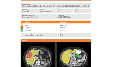 Photo of In-Med AI unveils Oncoshield – CT for liver pancreas cancer care